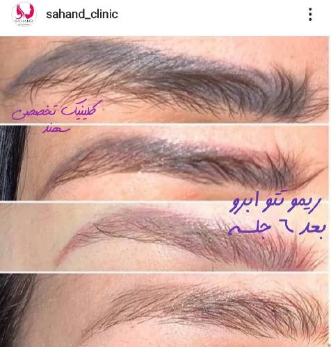 زیبایی - پوست و مو در تبریز
