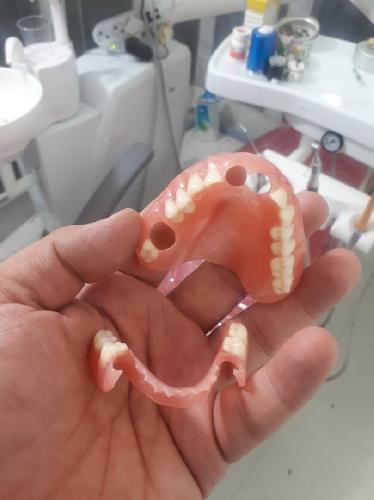 تزریقات+دندانسازی در تبریز