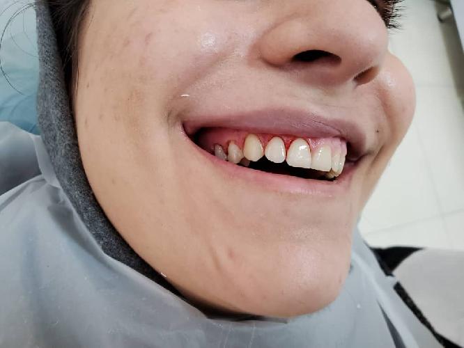 جراح دندانپزشک فلوشیب ایمپلنت از ICOIامریکا در تبریز