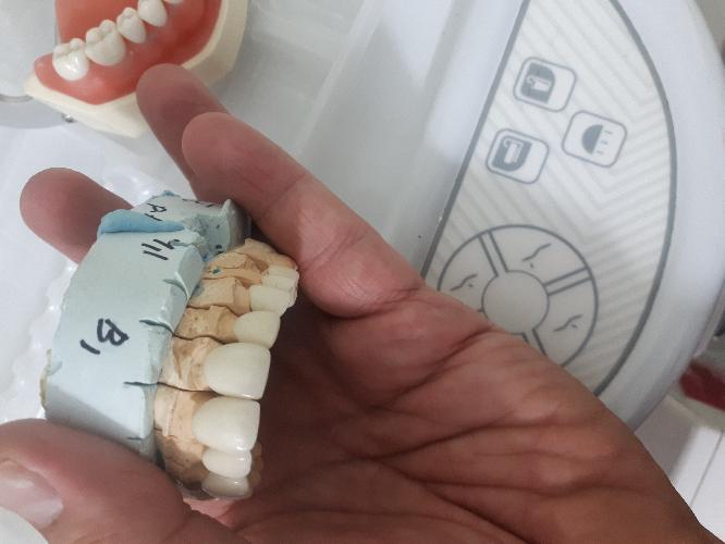 تزریقات+دندانسازی در تبریز