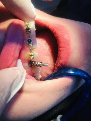 لابراتوار دندانپزشکی در تبریز