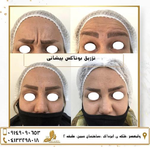 خدمات پوست و مو و زیبایی  و لیزر در تبریز