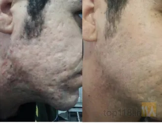 کلینیک پوست و مو در تبریز