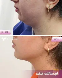مطب پوست و مووزیبایی در تبریز