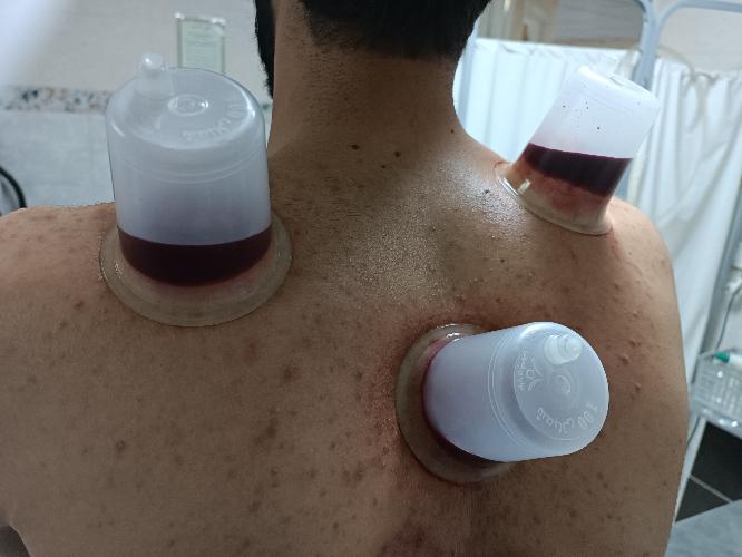 طب سنتی مرهم  در تبریز