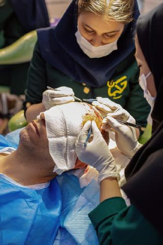 درمانگاه تخصصی کاشت مو و لیزر حکیمان در تبریز کاشت مو و لیزر زیبایی پوست و مو در تبریز