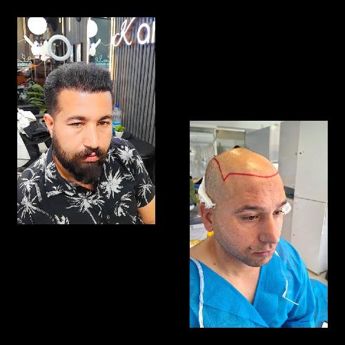 پوست و مو و زیبایی در تبریز