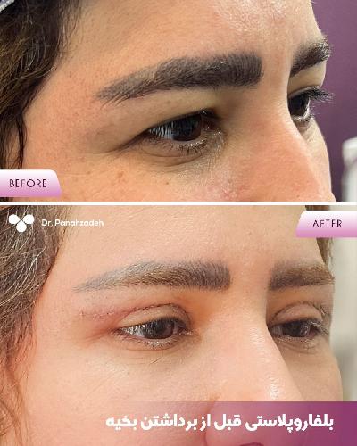 مطب پوست و مووزیبایی در تبریز