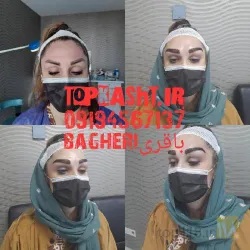 نمونه کار بهترین کاشت ابرو در تبریز کاشت ابروی باقری در تبریز - 9