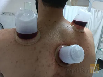 نمونه کار مرکز طب سنتی مرهم در تبریز - 9
