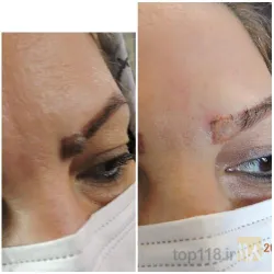 نمونه کار مطب پوست و مو دکتر صلح جو در تبریز - 9