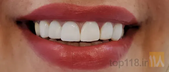 نمونه کار مطب دندانپزشکی  در تبریز - 9