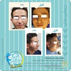 نمونه کار مطب پزشکی زیبایی دکتر حسن زاده  در تبریز - 9