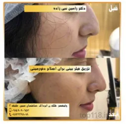 نمونه کار مطب دکتر رامین نبی زاده در تبریز - 9
