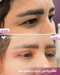 نمونه کار پوست مو و زیبایی لیزر دکتر مریم پناهزاده در تبریز - 8