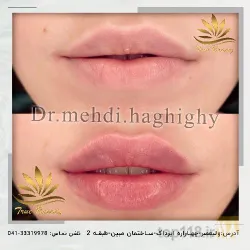نمونه کار کلنیک زیبایی پوست و مو دکتر حقیقی در تبریز - 9