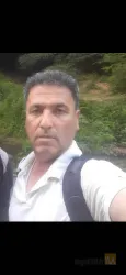 نمونه کار بهترین کاشت مو در تبریز  کاشت موی فرمانی در تبریز - 9