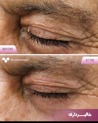 مطب پوست و مووزیبایی در تبریز