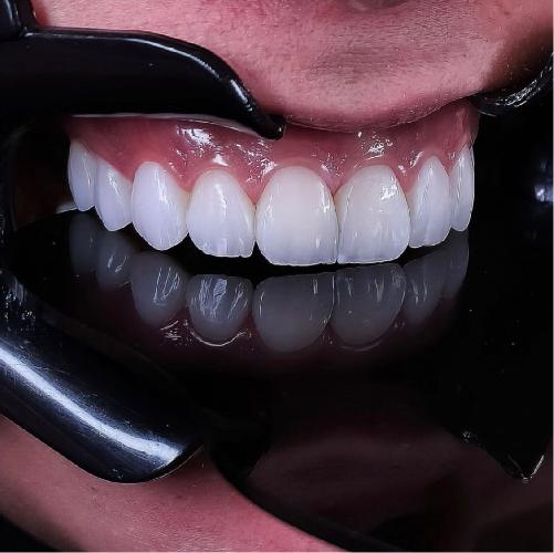 دندانپزشکی در تبریز