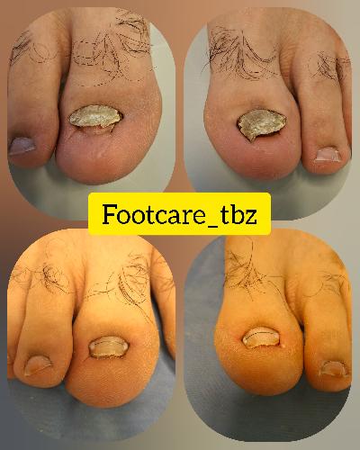 درمانی در تبریز