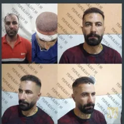 نمونه کار بهترین کاشت ابرو در تبریز کاشت ابروی باقری در تبریز - 1
