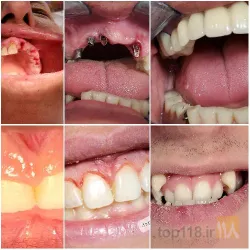 نمونه کار مطب دندانپزشکی  در تبریز - 1