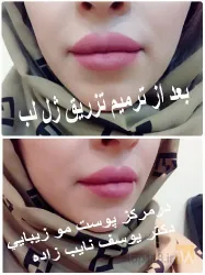 نمونه کار مطب دکتر یوسف نایب زاده  در تبریز - 1