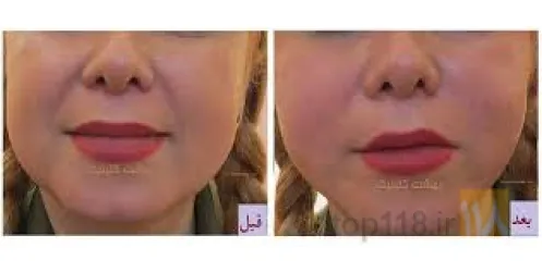 نمونه کار مرکز پوست و مو و زیبایی دکتر محمدی نژاد  در تبریز - 1
