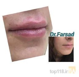 نمونه کار مطب دکتر مرتضی فرساد در تبریز - 1