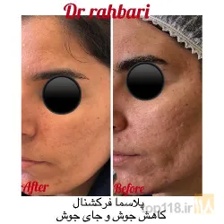نمونه کار زیبایی و پوست و مو دکتر رسول رهبری در تبریز - 1