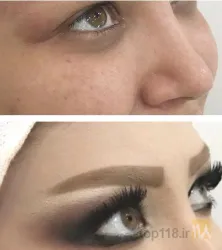 نمونه کار سالن زیبایی مرسده ( اسکان سابق ) در تبریز - 1