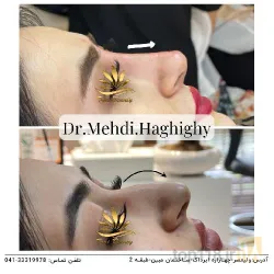 نمونه کار کلنیک زیبایی پوست و مو دکتر حقیقی در تبریز - 1