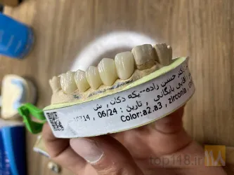 نمونه کار لابراتوار دندانپزشکی دنتال پلاس در تبریز - 1