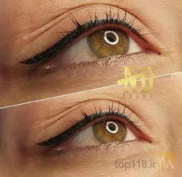 نمونه کار فیبروز ابرو - آرایش دایم در تبریز - 1