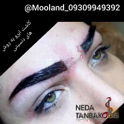 نمونه کار کاشت ابرو مولند در اصفهان - 1