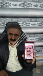 نمونه کار کلینیک تخصصی کاشت موی رحیمی در تبریز - 1