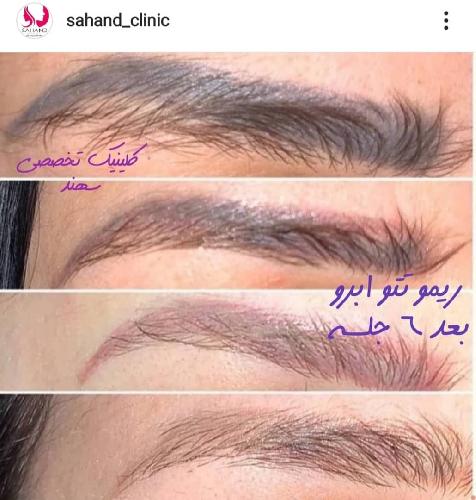 کلینیک پوست و لیزر سهند در تبریز زیبایی - پوست و مو در تبریز