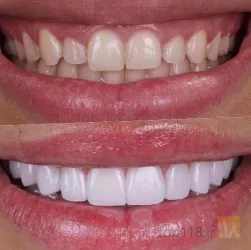 نمونه کار مطب دندانپزشکی دکتر وحید قاسم زاده در تبریز - 2