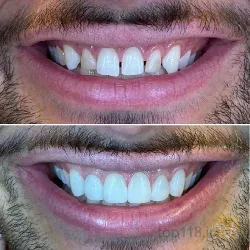 نمونه کار کلینیک دندانپزشکی فردوس در تبریز - 1