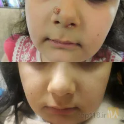 نمونه کار مطب پوست و مو دکتر صلح جو در تبریز - 2