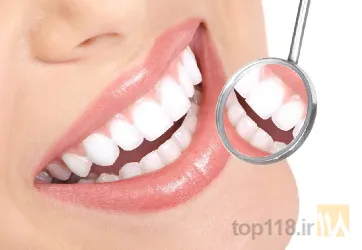 نمونه کار دندانپزشک تجربی یداله احمدی  در تبریز - 2