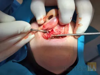 نمونه کار مطب دندانپزشکی  در تبریز - 2