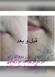 نمونه کار مطب دکتر یوسف نایب زاده  در تبریز - 2