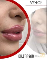نمونه کار مطب دکتر مرتضی فرساد در تبریز - 2
