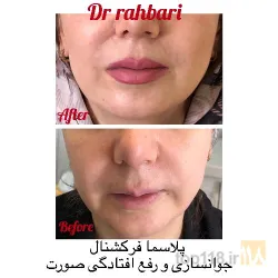 نمونه کار زیبایی و پوست و مو دکتر رسول رهبری در تبریز - 2