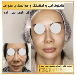 نمونه کار مطب دکتر رامین نبی زاده در تبریز - 2