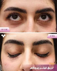 نمونه کار پوست مو و زیبایی لیزر دکتر مریم پناهزاده در تبریز - 2