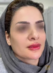 نمونه کار پوست و مو و لیزر الیزه در تبریز - 2