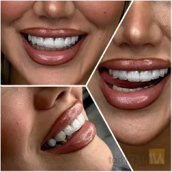 نمونه کار کلینیک  تخصصی دندانپزشکی مروارید در تبریز - 2