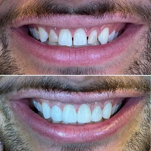 ارائه خدمات دندانپزشکی  در تبریز